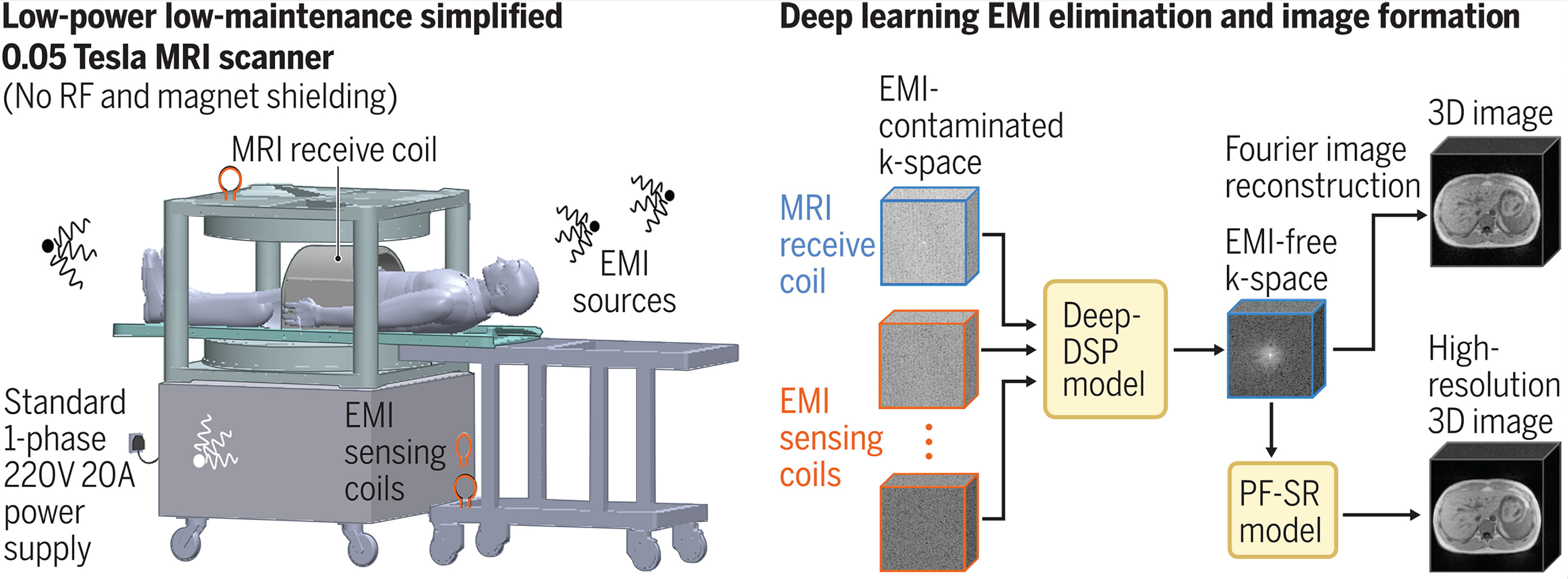 Prototype of a low-power, compact, and shielding-free MRI scanner using an open 0.05 Tesla permanent magnet. It incorporates active sensing and deep learning to address electromagnetic interference (EMI) signals.